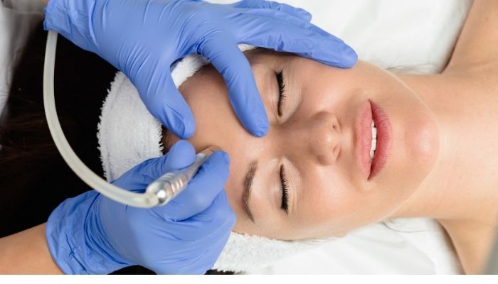 Microdermabrasion Therapy-Onsite
