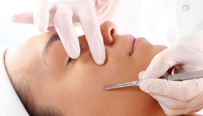 Dermaplaning